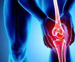knee-osteoarthritis-1588x840-1